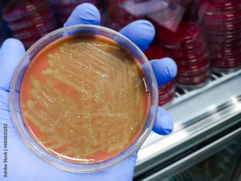 Mixed colony in Chocolate agar media, Stresptococcus colonies, Gram