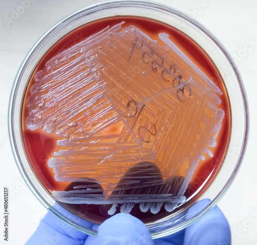 Colonies of bacteria in petri dish (blood agar), mixed bacterial colonies. photo