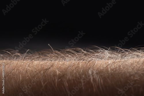 Human skin with hair on black background. Goose bumps
