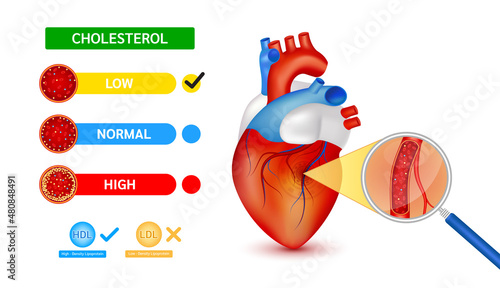Medical blood test using a magnifying glass cholesterol meter scale comparison with HDL and LDL lipoprotein. Normal blood flow and Cholesterol in human heart. Hematologic diseases concept. Vector.