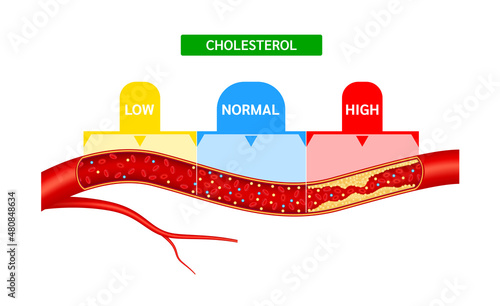 Cholesterol meter or scale comparison with HDL High density lipoprotein and LDL Low density lipoprotein. Normal blood flow and Cholesterol artery thrombosis disease. ​​Medicine and health Vector.