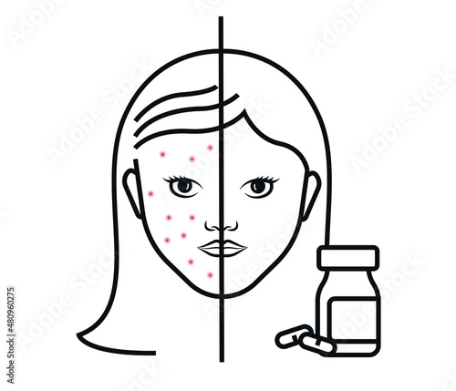 acne treatment with medication skin care and skin health concept. Isolated on white background. editable vector.
