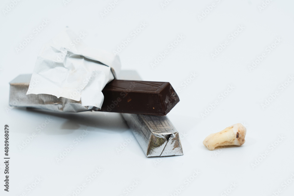 Human tooth caries with chocolate (sweets) on white background Human tooth caries with chocolate (sweets) on white background
