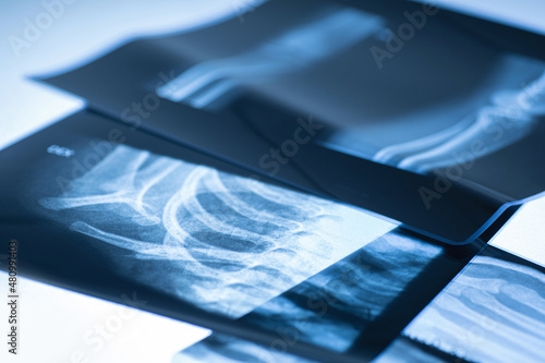 Closeup of different x-ray images