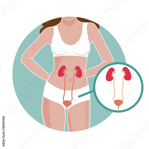 Urinary female tract and beautiful body