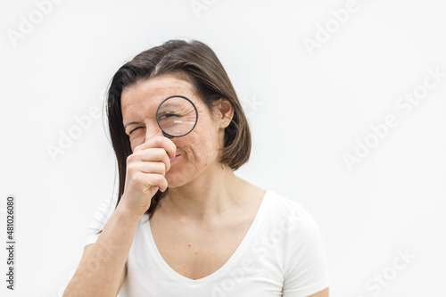 Close up photo of woman with dry skin with magnifying glass.
