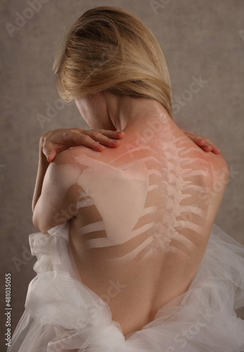 Woman suffering from upper back pain . Chiropractic, Physiotherapy Concept.