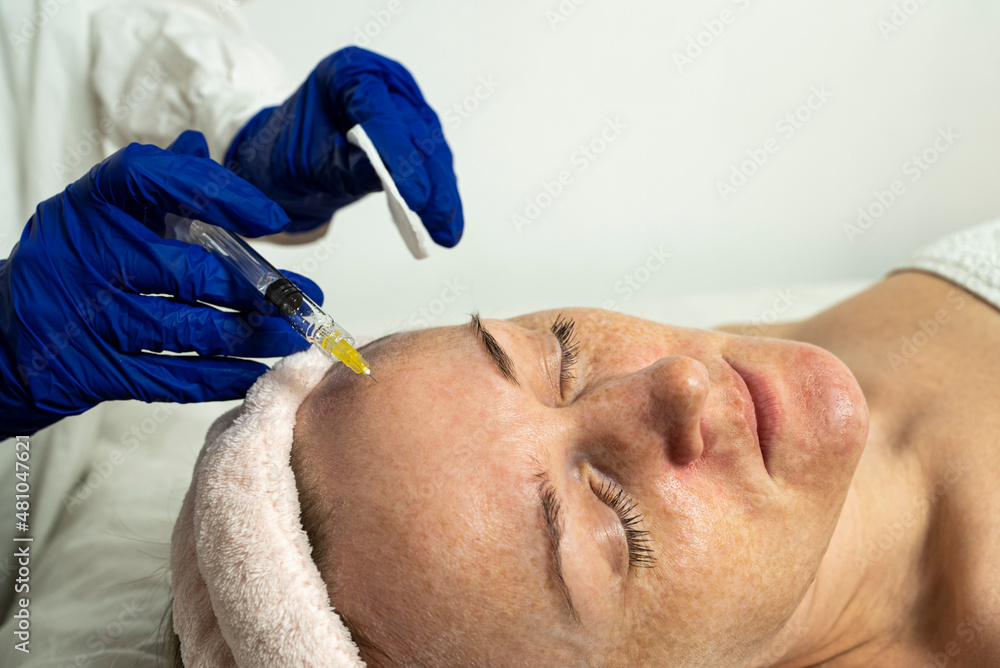 Needle mesotherapy in a beauty clinic. Cosmetics are injected into the woman's face Needle mesotherapy in a beauty clinic. Cosmetics are injected into the woman's face