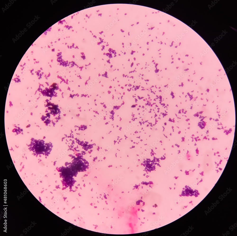 Gram staining, It is a method of differentiating bacterial species into two large groups(Gram