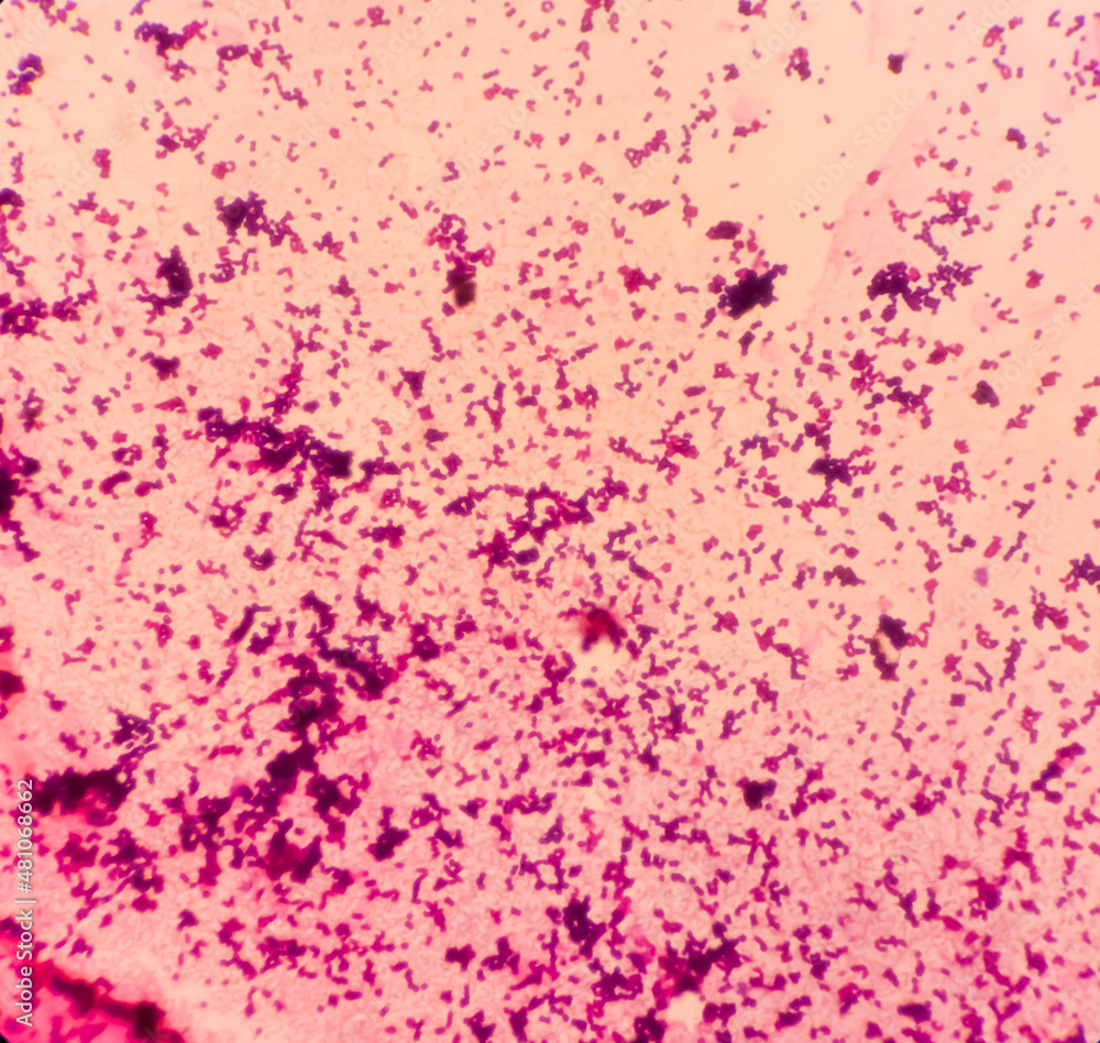 Gram staining, It is a method of differentiating bacterial species into two large groups(Gram