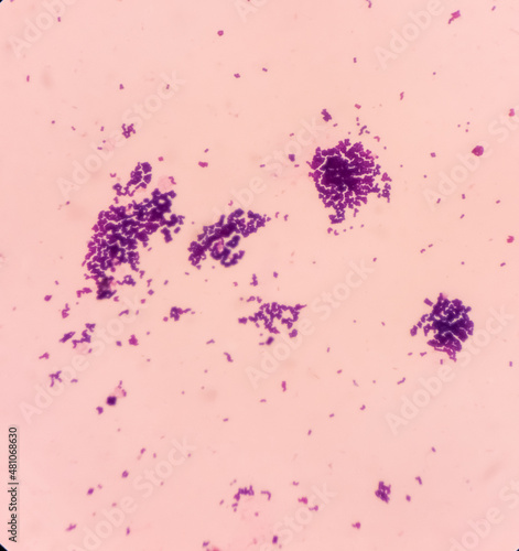 Gram staining, It is a method of differentiating bacterial species into two large groups(Gram-positive and Gram-negative), show gram positive blue color and gram negative red color photo