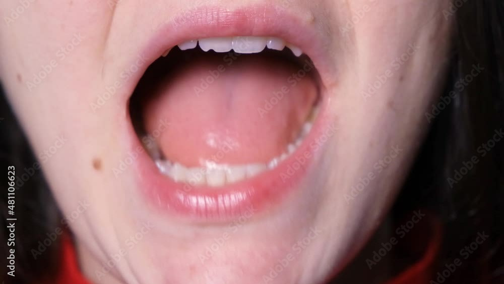 A patient with temporomandibular joint dysfunction opens his mouth