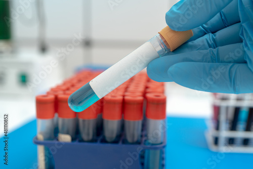 Test tube with empty label  to biological sample for medical laboratory research   on lab props background