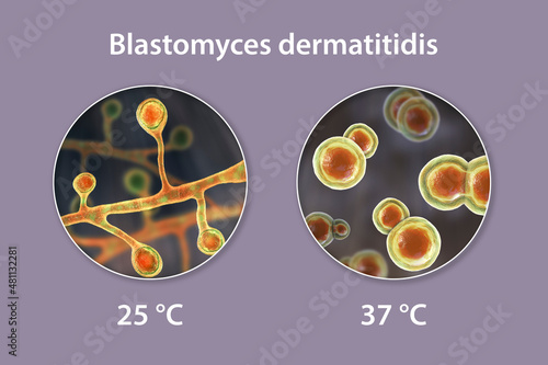 Blastomyces dermatitidis fungi photo