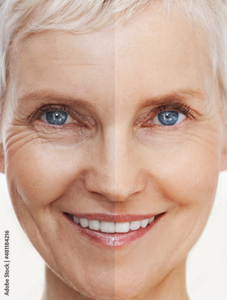 Aging gracefully and beautifully. Before and after shot of a beautiful senior woman's face.