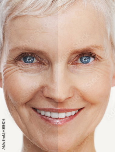 Aging gracefully and beautifully. Before and after shot of a beautiful senior woman's face. © Delmaine D/peopleimages.com