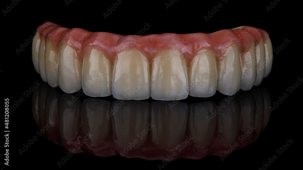 excellent shot of a dental prosthesis of the upper jaw made of titanium and ceramics on black glass with reflection excellent shot of a dental prosthesis of the upper jaw made of titanium and ceramics on black glass with reflection