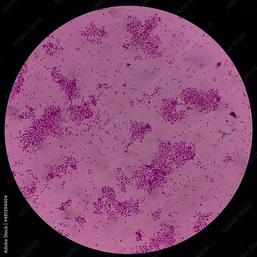 Gram stain, to differentiate bacterial species into two large groups(Grampositive and Gram
