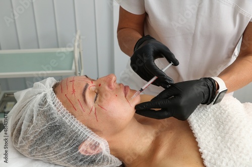 Beautician gives wrinkle injections to a middle-aged woman.
