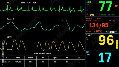 ECG System Ui Monitoring Health Condition Of Patient. Electrocardiogram System Monitoring And Recording Health Of Vital Organs. Monitoring System Testing Heart Health By Analyzing Electrical Signals