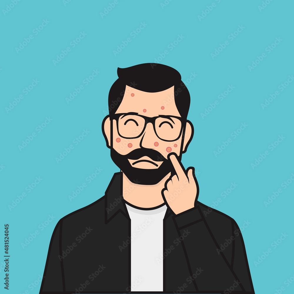Flat Bearded Man Pointing Hand at His Pimple Vector Illustration Flat Bearded Man Pointing Hand at His Pimple Vector Illustration