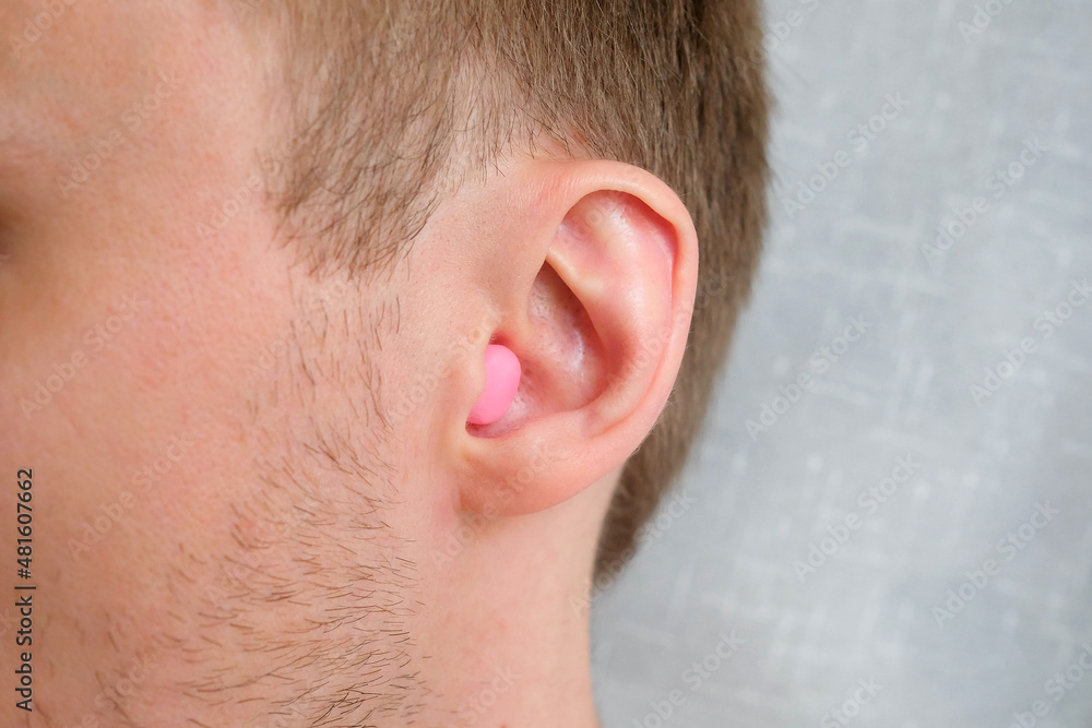 A pink wax earplug is inserted into the ear A pink wax earplug is inserted into the ear