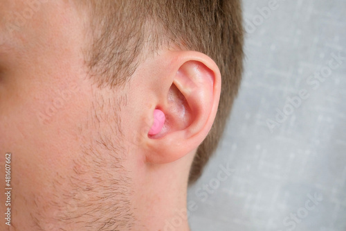 A pink wax earplug is inserted into the ear photo