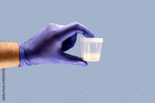 hand wearing nitrile glove holding semen or sperm sample collection container, semen donation concept photo