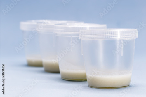 sperm collector vials and containers, semen donation concept, copyspace for text photo