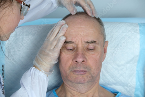 Anti-aging treatments for balding men. Close-up trichologist in gloves examines patient, bald charismatic mature man with alopecia in hair growth clinic. concept of hair loss in men, selective focus