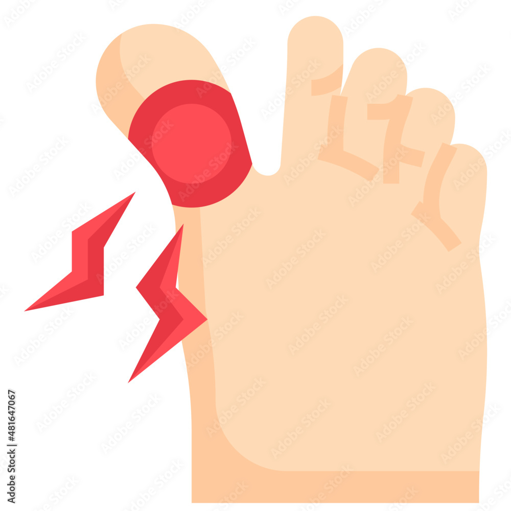 FINGER FRACTURE flat icon