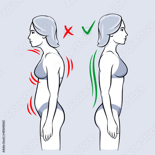 Standing postures infographic outline diagram. Woman with poor and good posture vector illustration