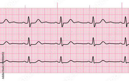 Heart beat ecg or ekg seamless black line on pink paper. Electrocardiogram graph of healsh cardio rate. Examination of human health. Medicine test cardiac rhythm and pulsating inteval.