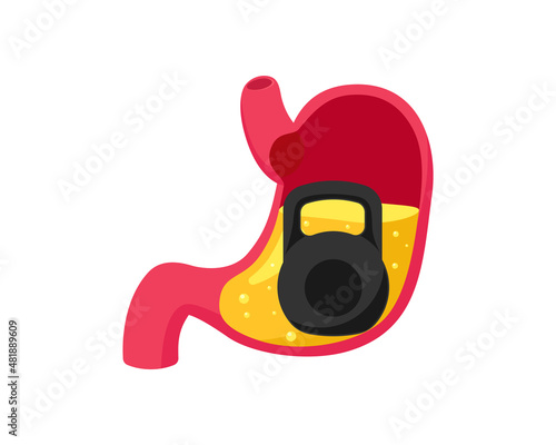 Stomach heaviness with heavy weight dumbbell inside. Digestive system problem. Overeating indigestion and belly disease. Abdominal gastric pain medical vector eps illustration