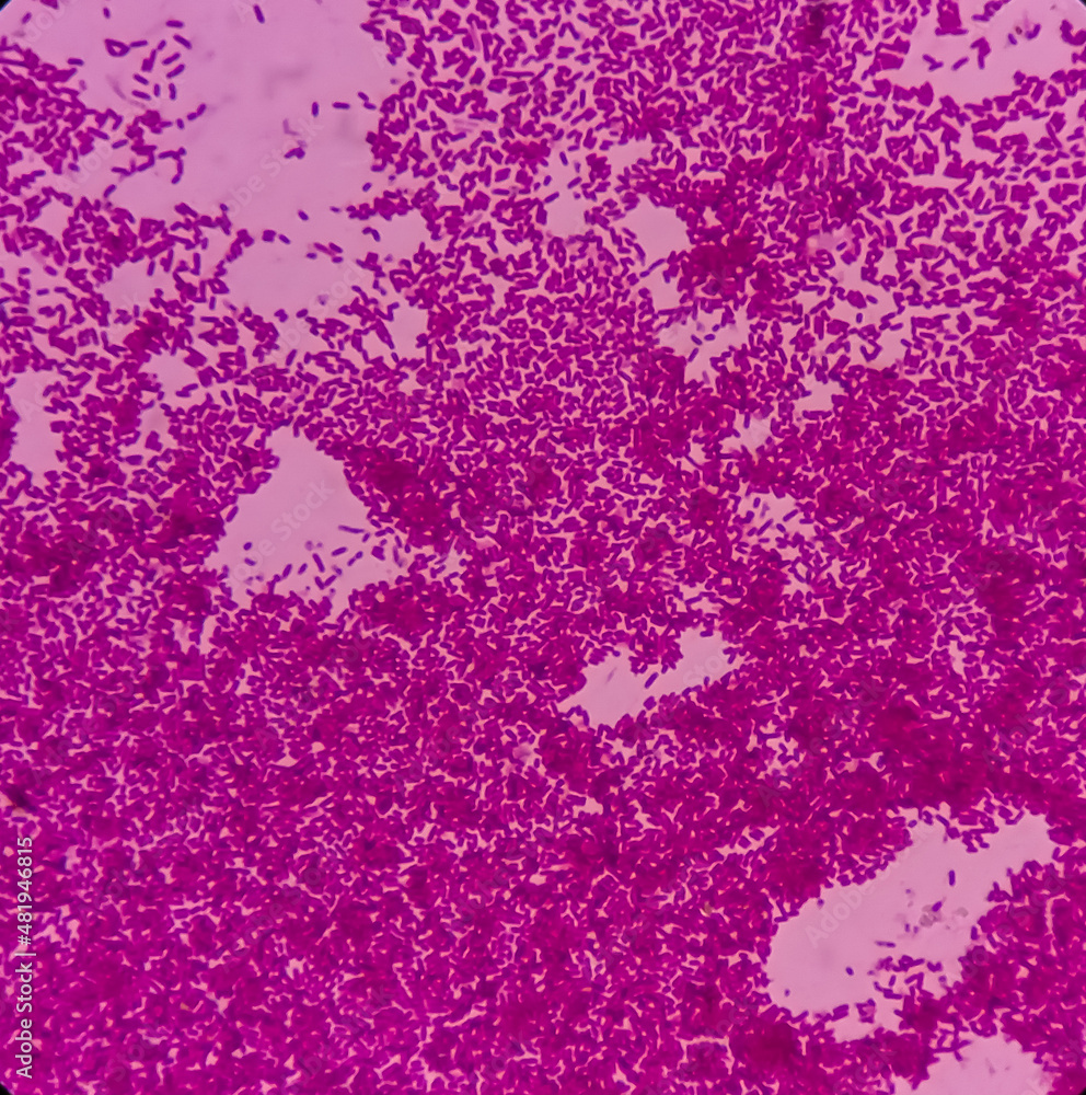 Escherichia coli bacterium, E.coli, gramnegative rodshaped bacteria