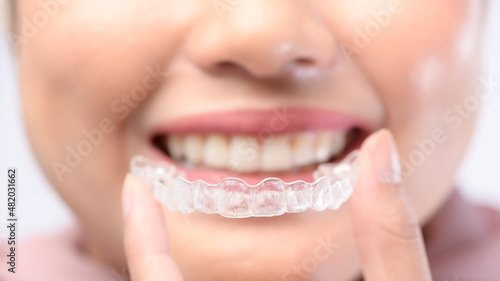 Young smiling woman holding invisalign braces over white background studio  dental healthcare and Orthodontic concept.