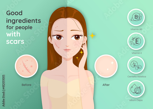 Good ingredients for people with scars