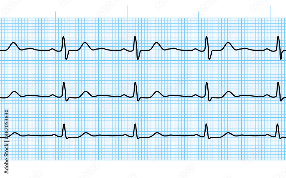 Heart beat ecg or ekg seamless black line on blue paper. Electrocardiogram graph of healsh cardio rate. Examination of human health. Medicine test cardiac rhythm and pulsating inteval.