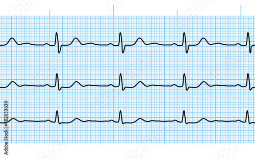 Heart beat ecg or ekg seamless black line on blue paper. Electrocardiogram graph of healsh cardio rate. Examination of human health. Medicine test cardiac rhythm and pulsating inteval.