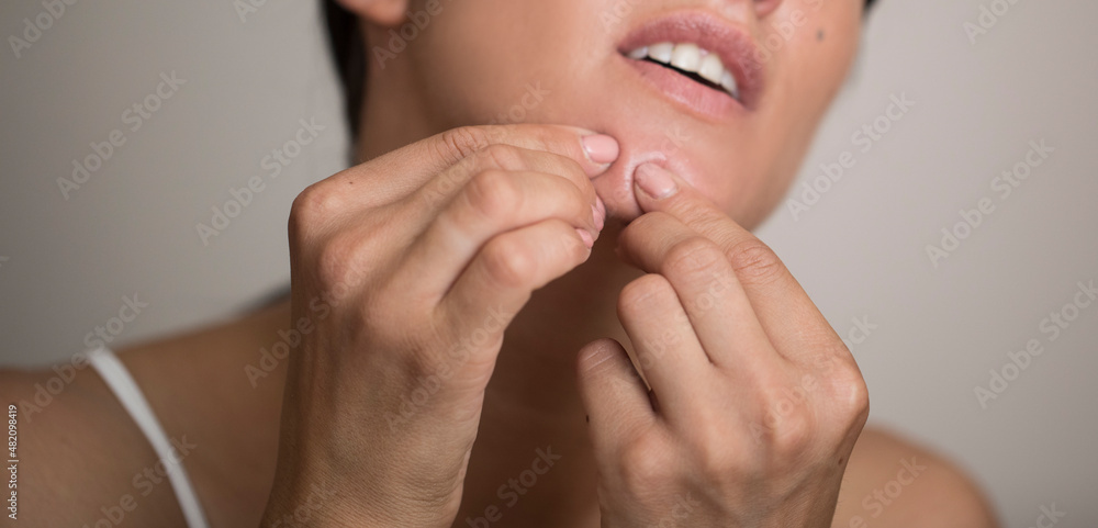Woman, remove, facial. Acne. Problem
Woman, remove, facial. Acne. Problem