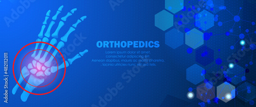 Abstract science medical orthopedics of wrist  and hand injury. The concept for hospital and research.