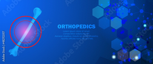  Abstract science medical orthopedics of humerus and forearm injury. The concept for hospital and research.