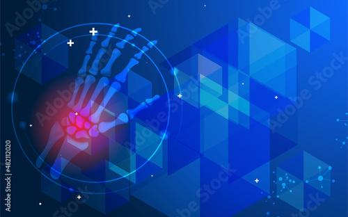Abstract science medical orthopedics of wrist  and hand injury. The concept for hospital and research.