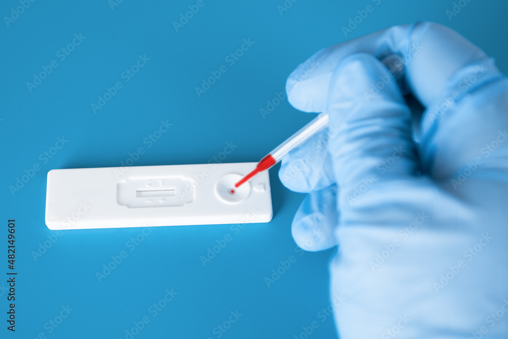 doctor doing a blood test for coronavirus antibodies doctor doing a blood test for coronavirus antibodies