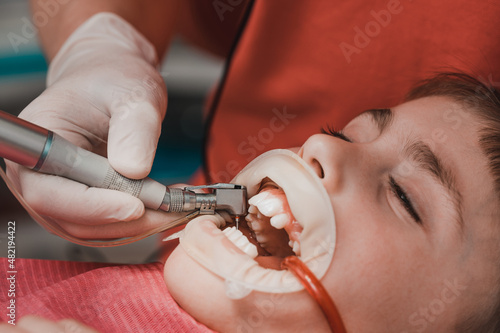 Dentist cleans tooth decay in a child with a drill, in the child's mouth ejector saliva.