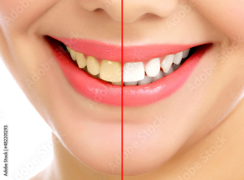Young smiling woman, white background, copyspace. Before and after concept.