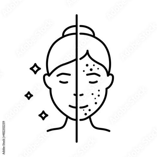 Woman with Acne and Clean Face Skin Line Icon. Girl Before and After Skin Treatment Linear Pictogram. Female Skincare for Cleansing Face Outline Icon. Editable Stroke. Isolated Vector Illustration