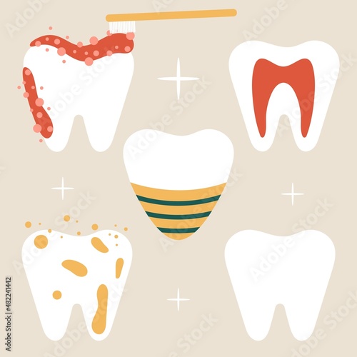 set of elements with clean teeth, stains, toothpaste, implant and toothbrush, flat vector illustration