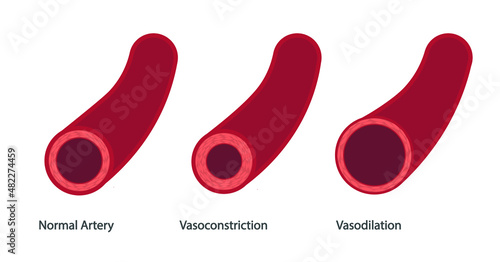 Vasodilation and Vasoconstriction illustration. Different thickness of a artery vessel wall photo