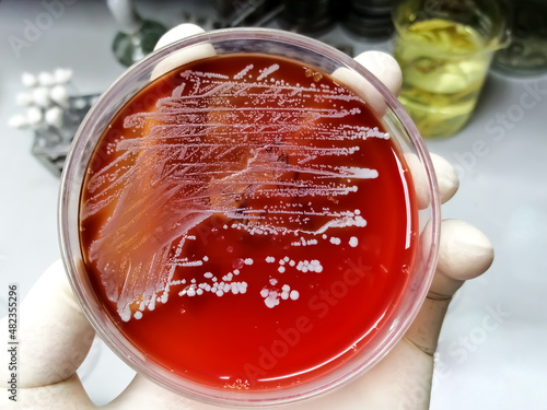 Staphylococcus aureus: Gram-positive, to Gram-variable, nonmotile, Coccus, beta hemolysis, saprotrophic bacterium that belongs to the family Staphylococcus growth on blood agar. photo